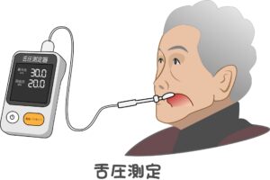 舌圧測定