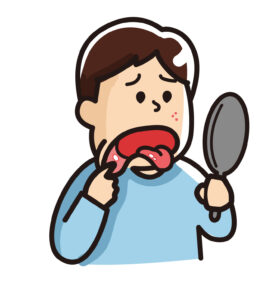 口内炎ができた酸性
